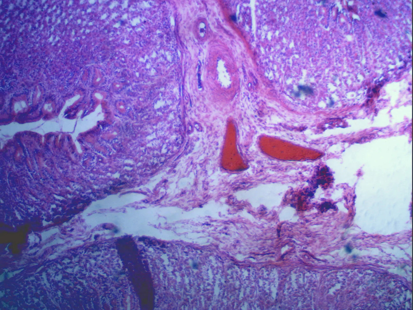 Digital Microscope Imager HD 5MP